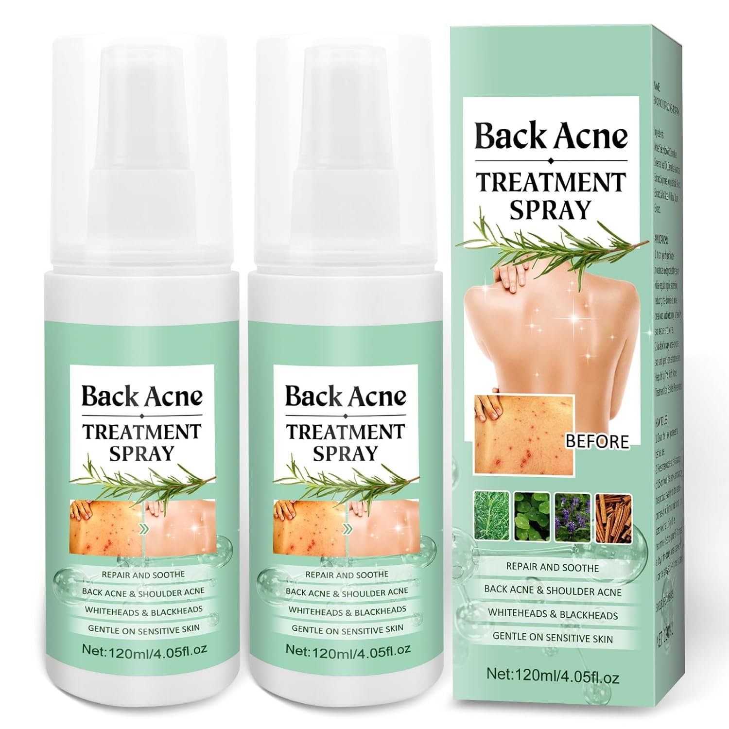 Back Acne Treatment With Herbal Formula, 2% Salicylic Acid & Tea Tree Oil – Body Spray Solution for Acne, 120ml (2PCS)